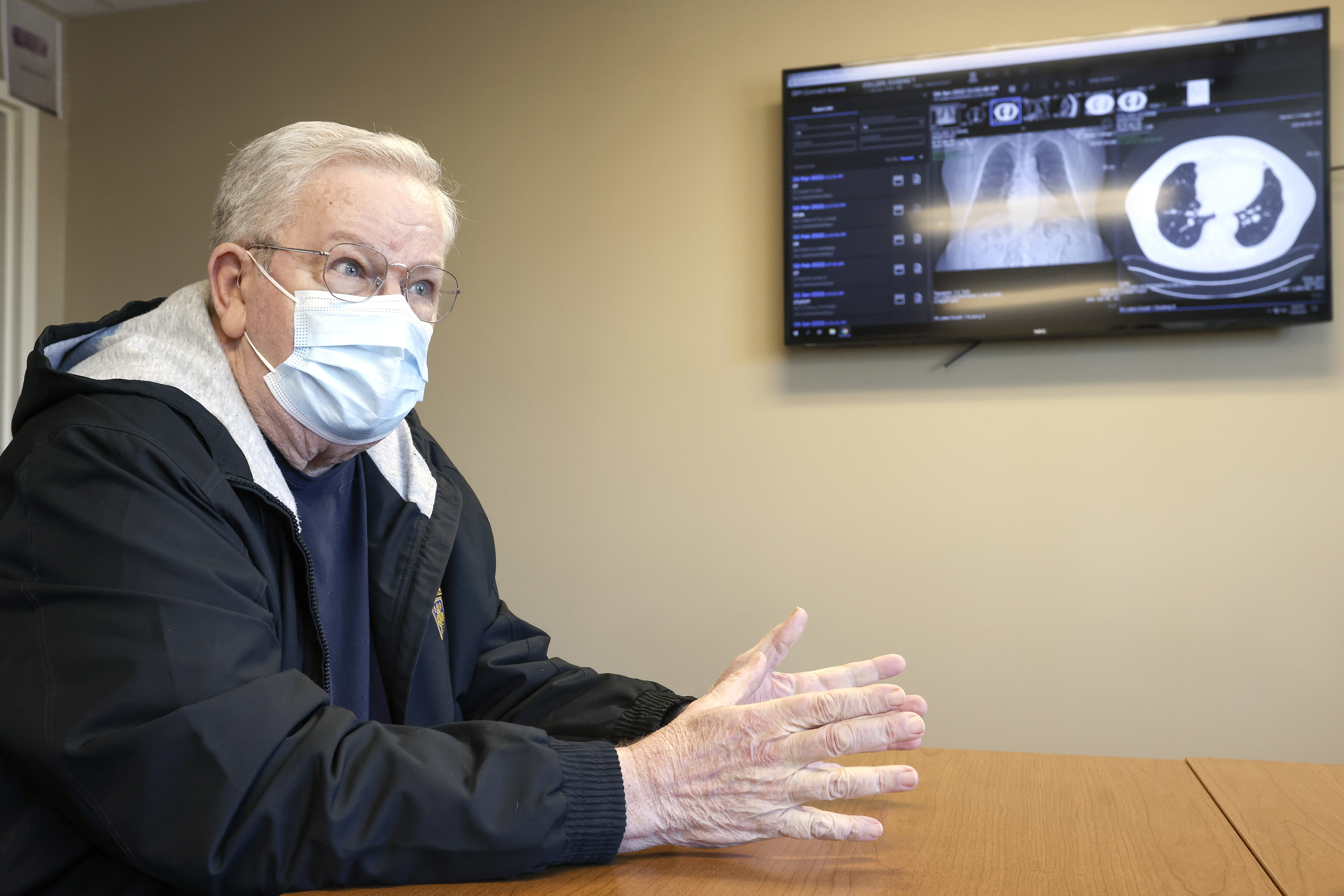 Routine lung cancer screening recommended for more current, former smokers - Vimarsana News