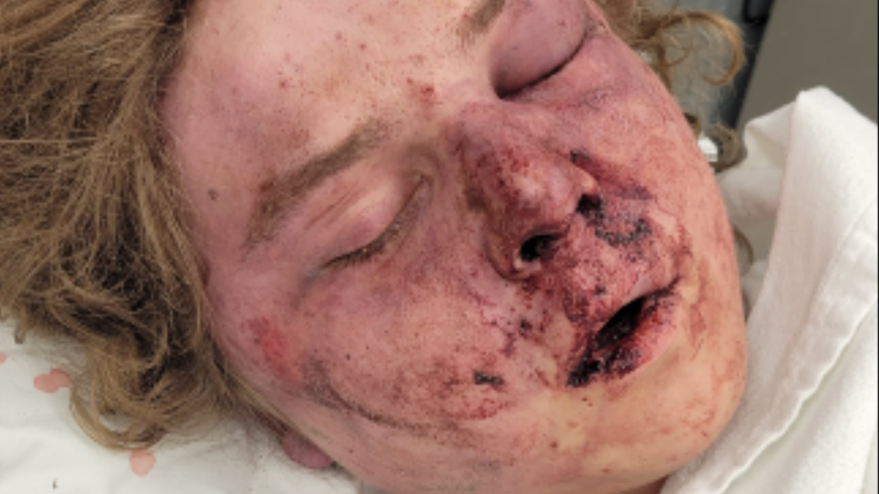 'Just about killed my son:' Family, community frustrated with police department after random attack - Vimarsana News