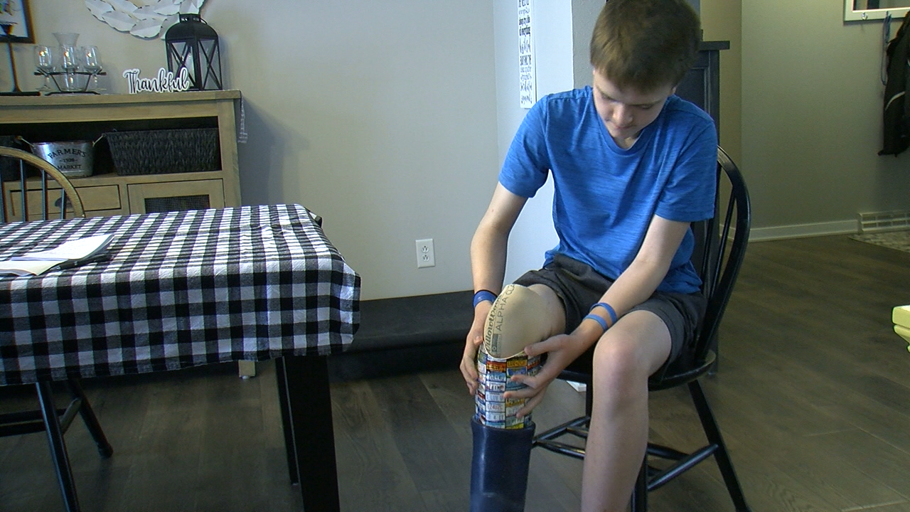 Minnesota teen loses leg, but not his perseverance - Vimarsana News
